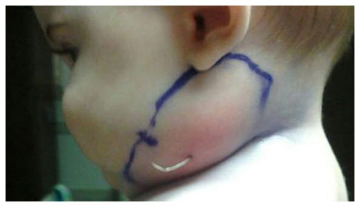 دختری با صورت پردار_عکس